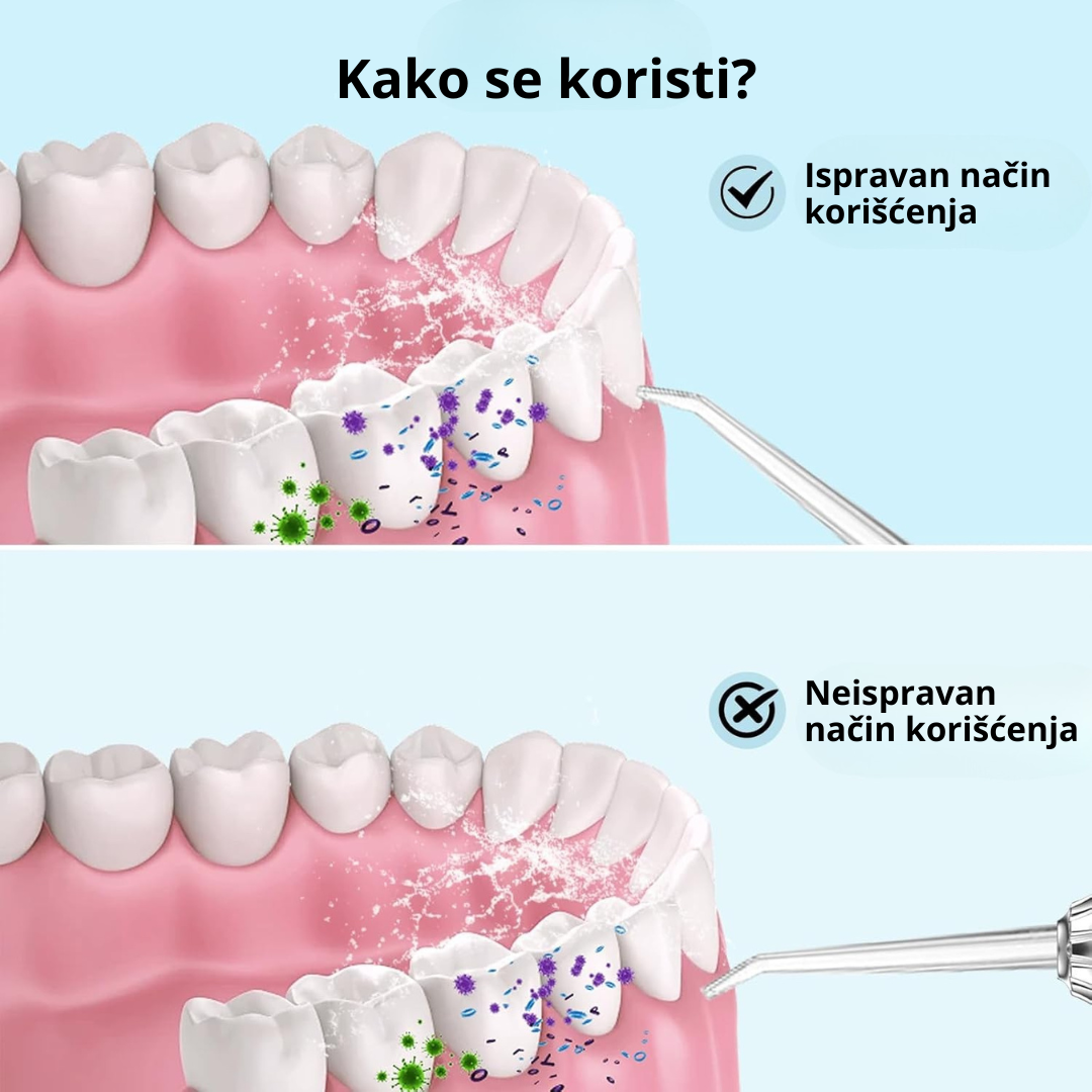 Irigator za čišćenje zuba i desni